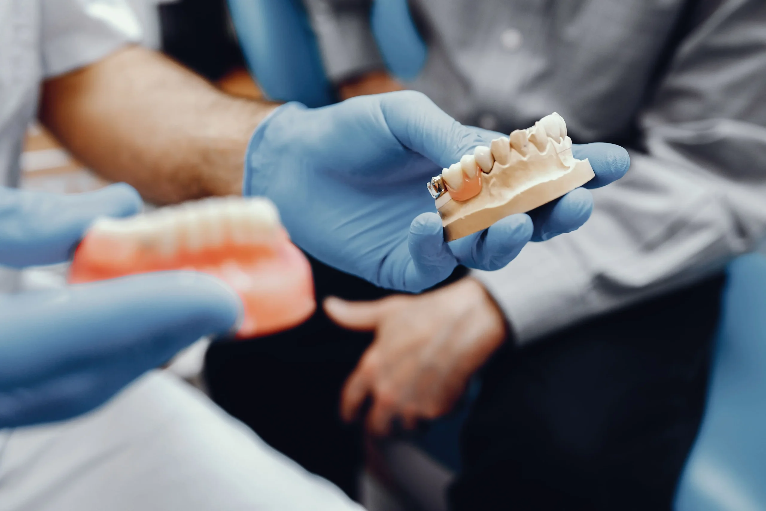 Cuánto dura un implante dental y de qué depende su duración en la sierra cordoba
